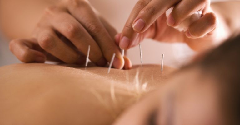 Headaches? Migraines? osteopathy and acupuncture may be the answer