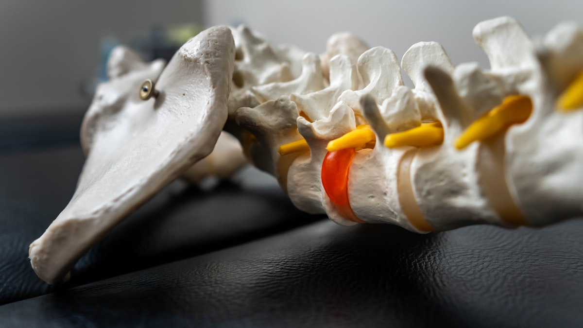 Disc Injury Management: How Osteopathy Can Help